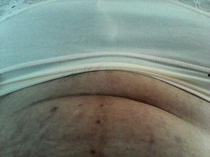 割妇产视频,医学奇迹与人性关怀